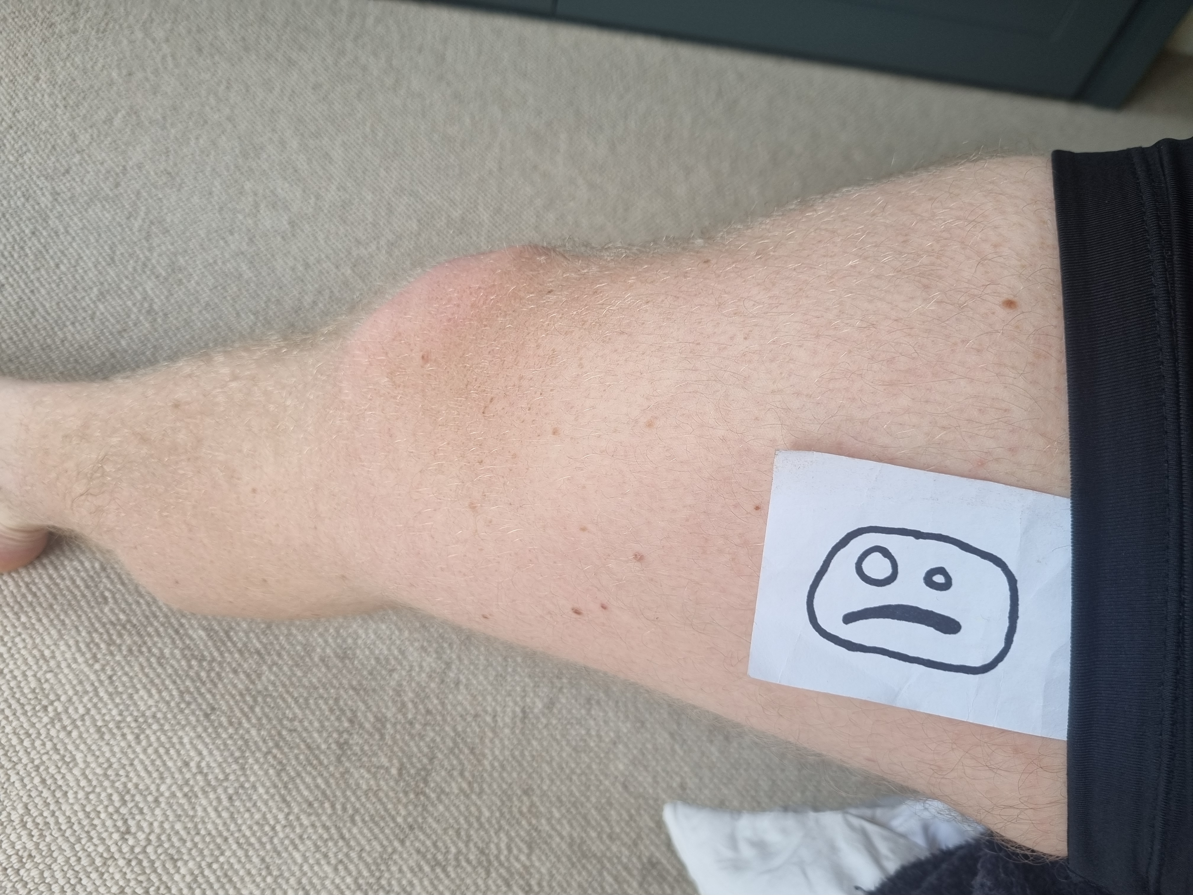 thigh.jpg