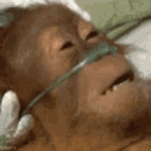 hospital-cant-breath.gif