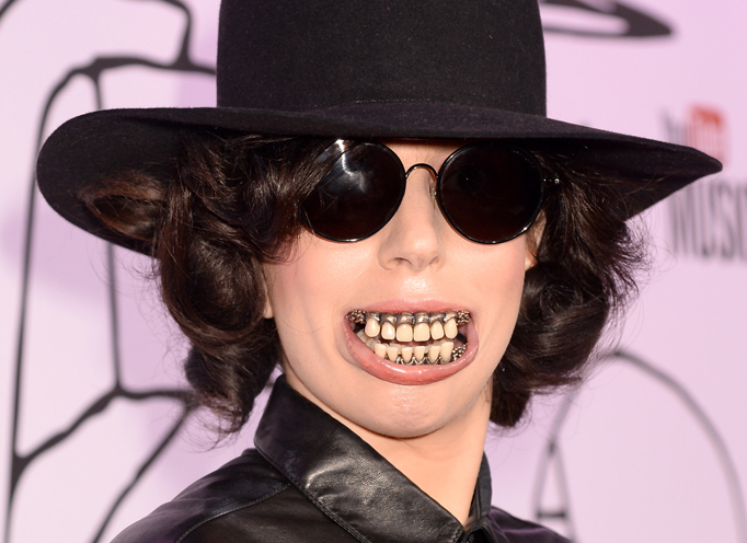 lady-gaga-dentures.jpg