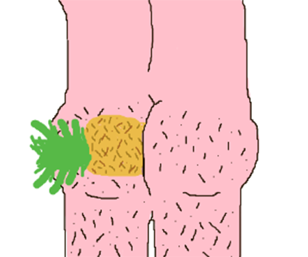 rpvLJCn.png